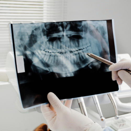 cirugia_oral_madrid