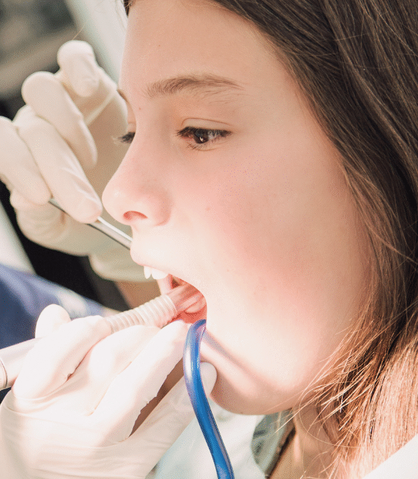 limpieza_dental_madrid