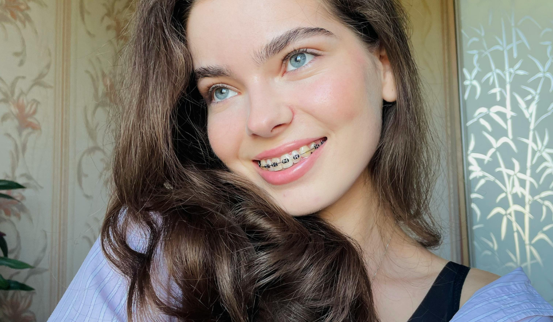 duele_ponerse_brackets