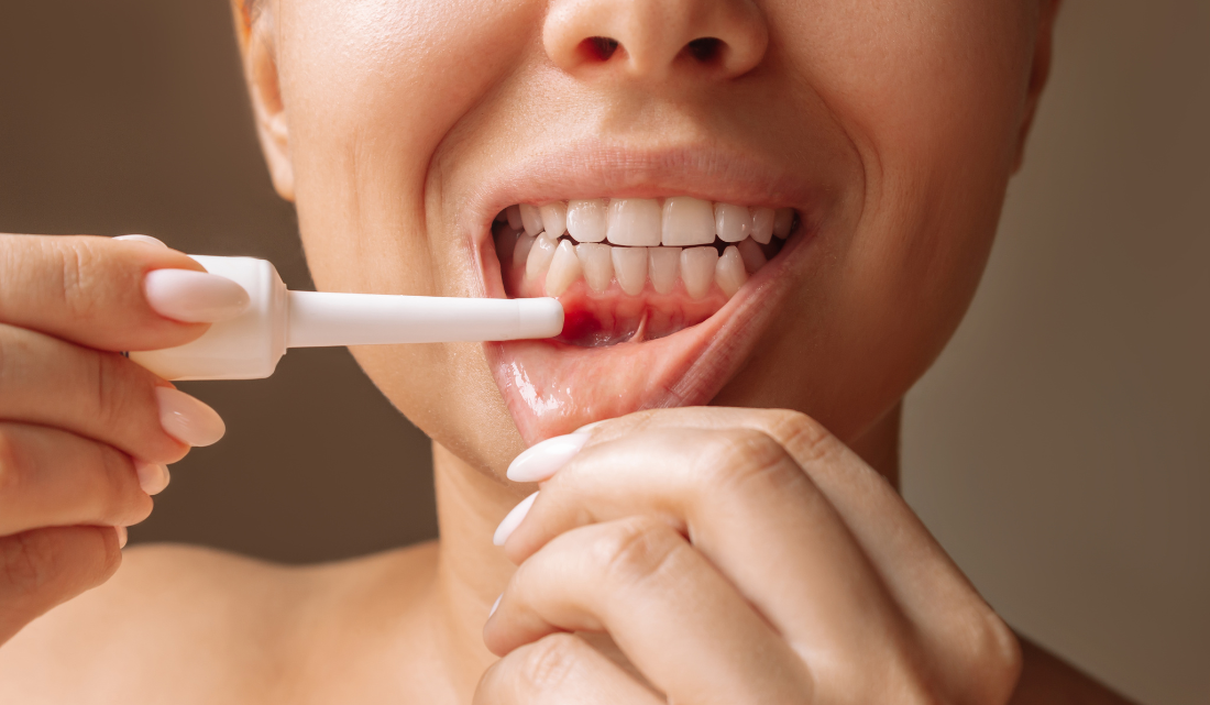 Tratamiento_de_periodontitis_y_encías_inflamadas_en_Clínica Dental_Los_Ángeles.