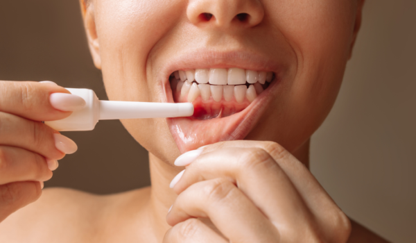 Periodontitis