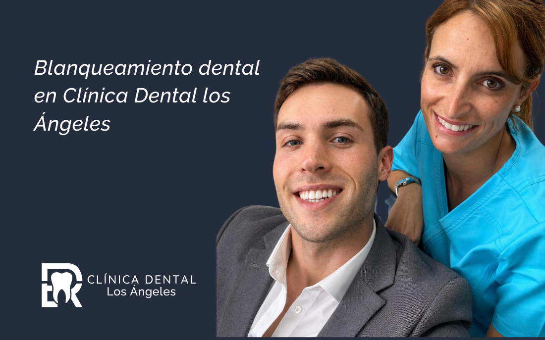 blanqueamiento_dental