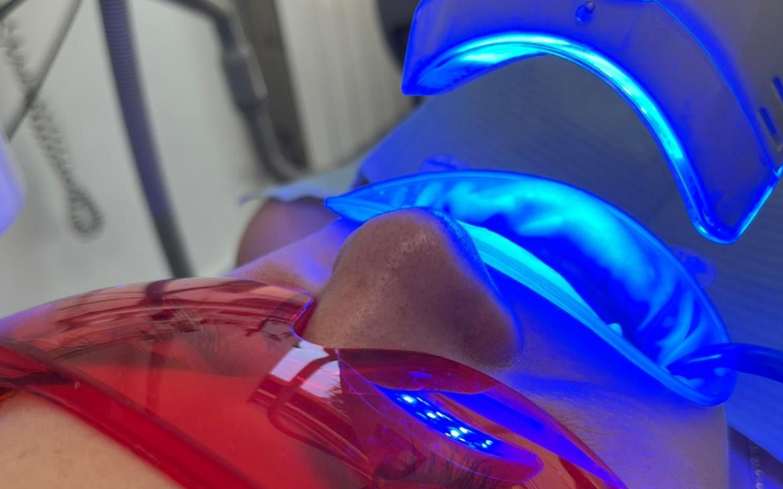 blanqueamiento_combinado_clinica