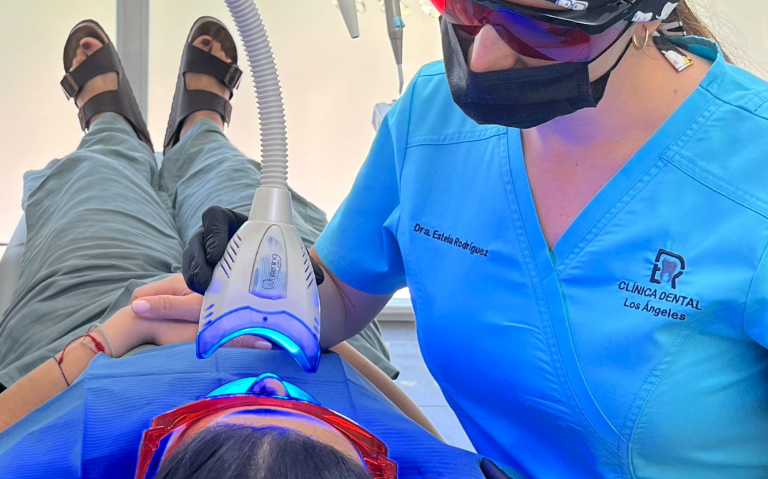 blanqueamiento_clinico_madrid