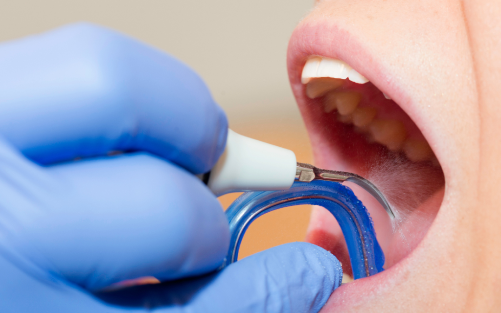 limpieza_dental