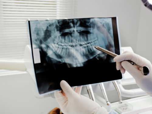 cirugia_oral_madrid_usera
