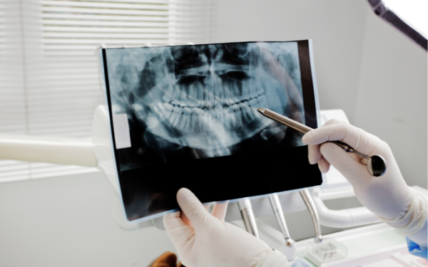 cirugia_oral_madrid_usera