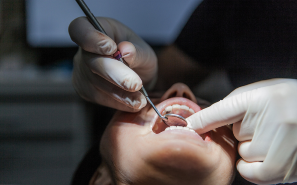 tratamientos_de_cirugia_oral_avanzada